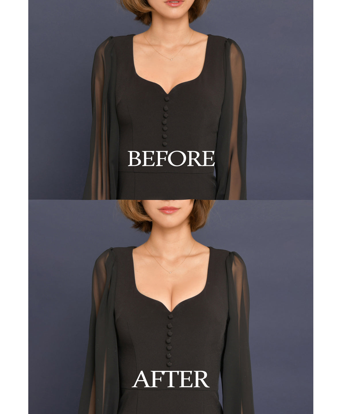 M BACK LESS BRA