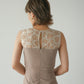 UNBILLION LACE DRESS